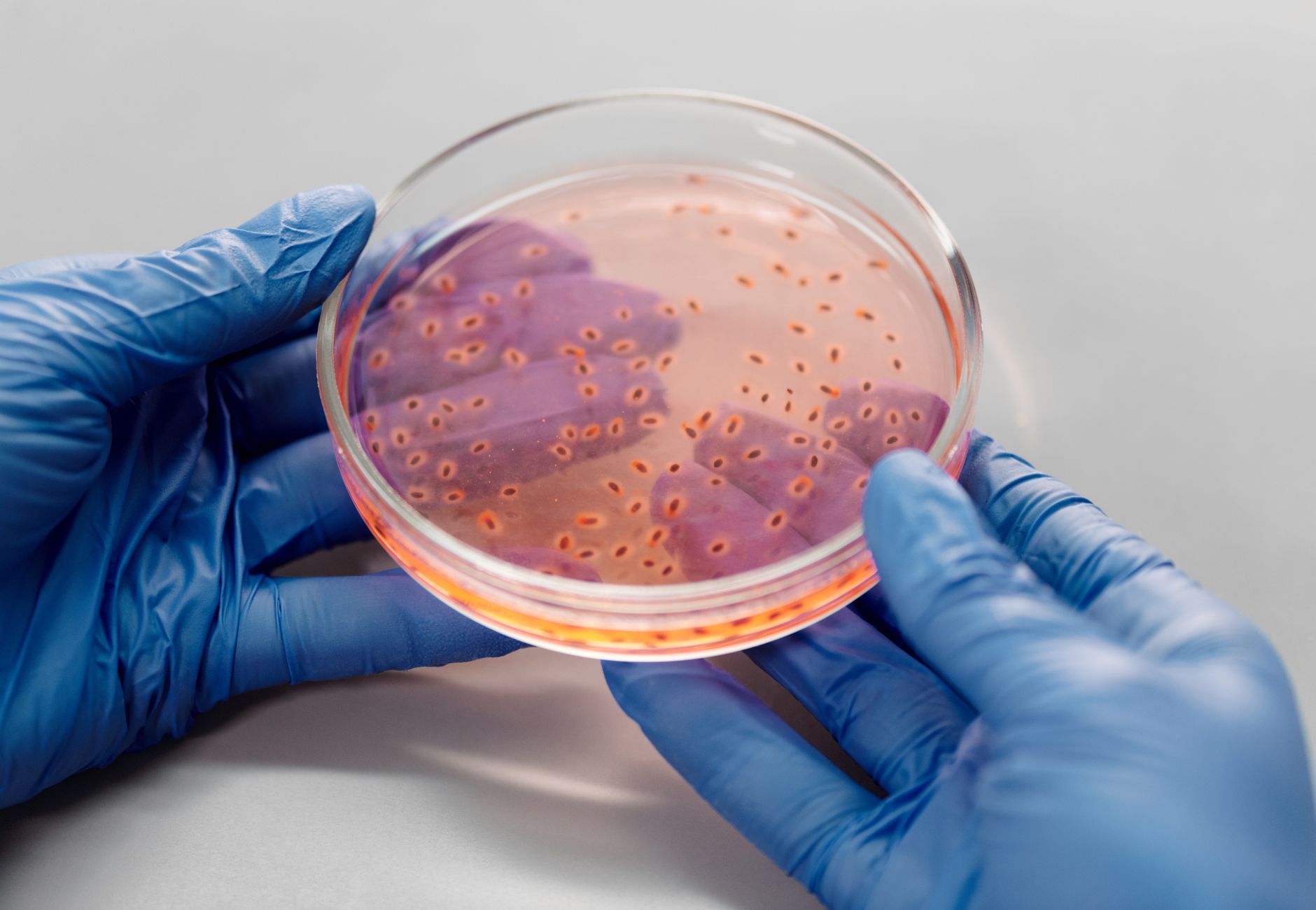 Close-up of gloved hands holding a petri dish with bacterial culture in a lab setting.