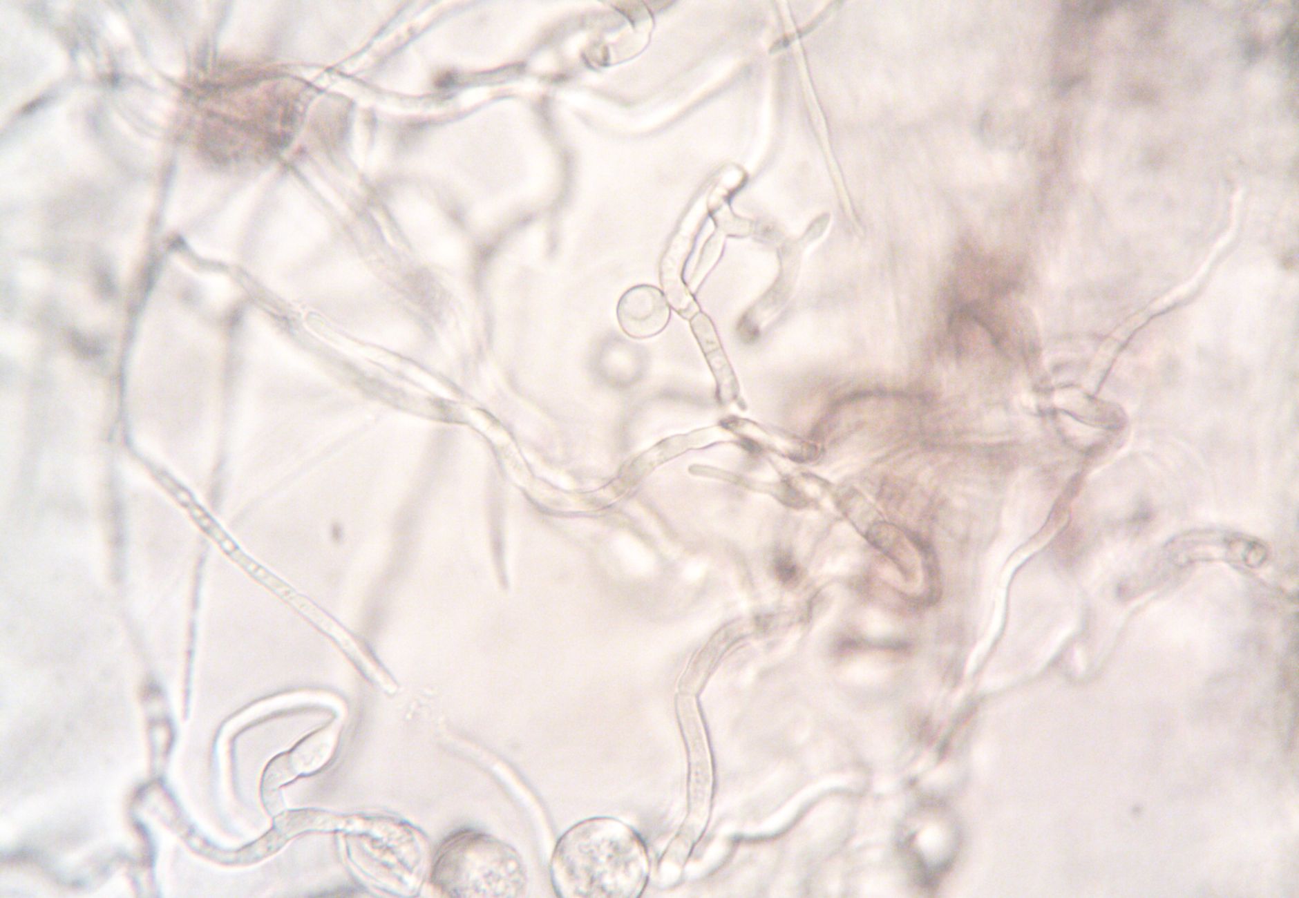 Close-up image depicting the detailed structure of fungal hyphae under a microscope.